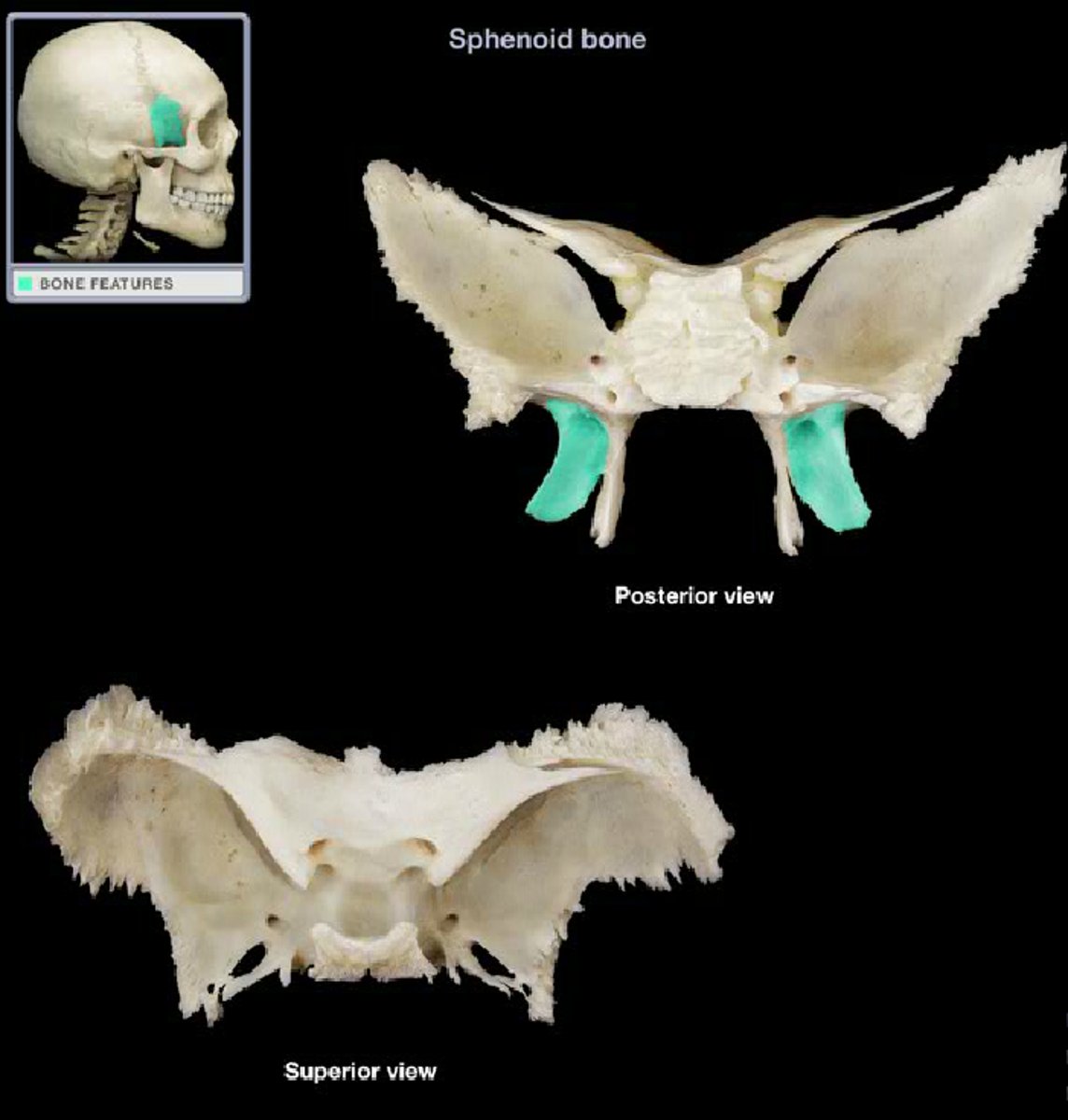 <p>What is this boney feature?</p>