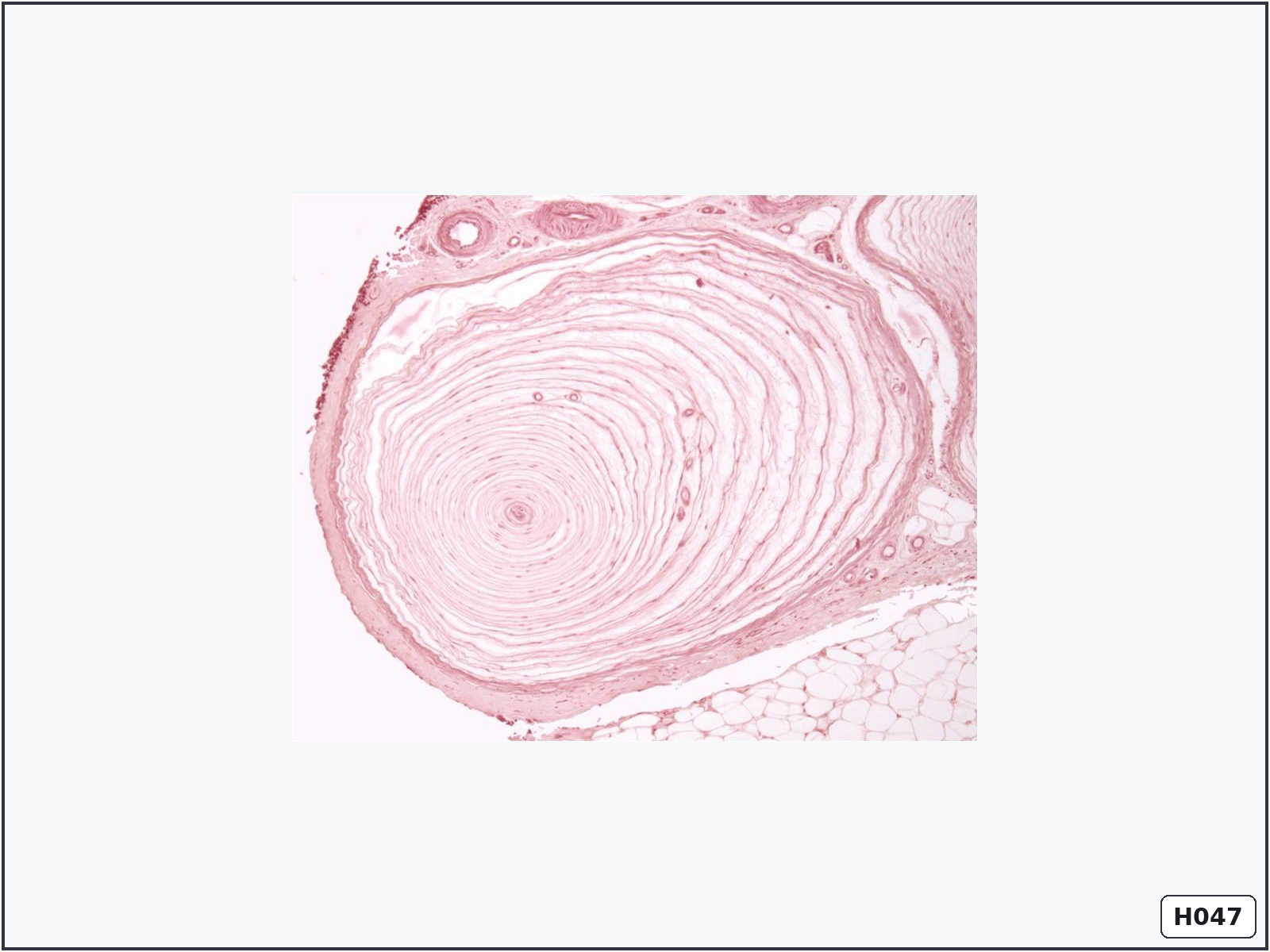 term image