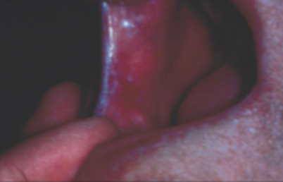 <p>what is this condition</p>