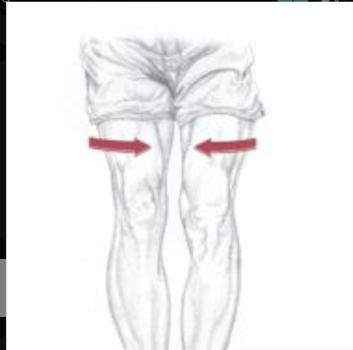 <p><span>Which of the following are the synergists of the motion depicted below? Select all that apply.</span></p>