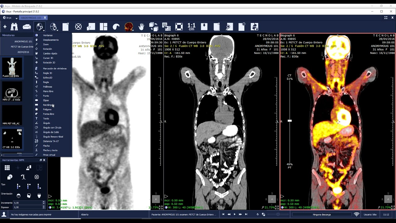 <ol><li><p>image fusion</p></li><li><p>forms images with the “best of both words” Structure AND function seen together = more dynamic view</p></li></ol><p></p>