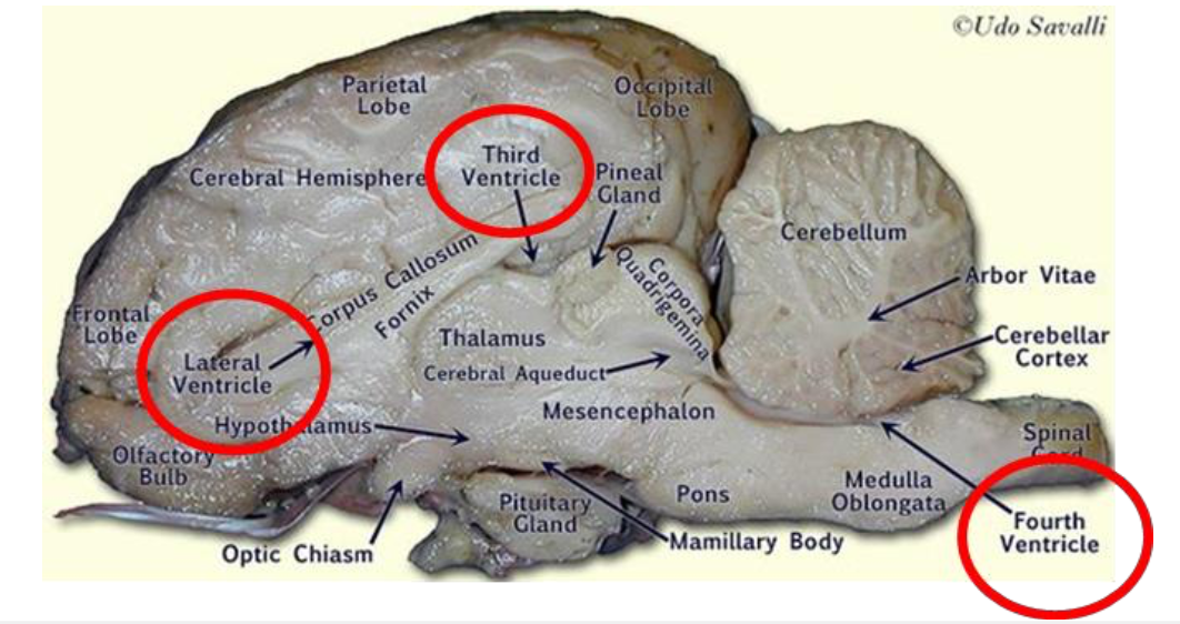 <p>Lateral Ventricle - Inside </p>