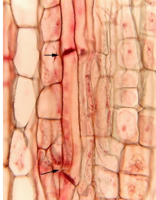<p>photo shows a section of phloem under microscope<br><br>Draw a low power plan diagram.</p>