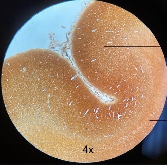 <p>what type of tissue?</p>