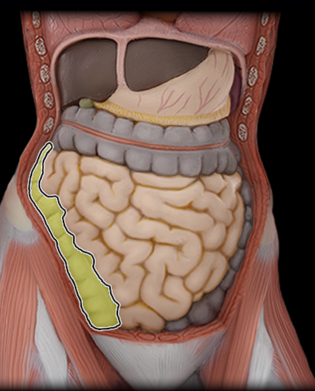 <p>ascending colon</p>