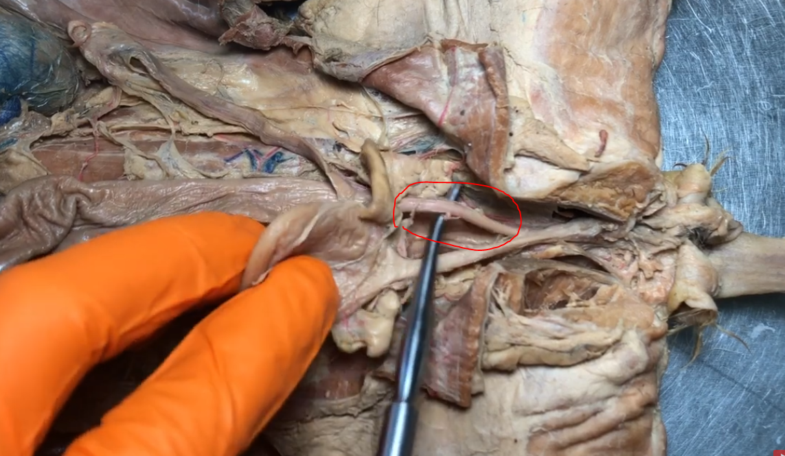 <p>What is this passageway below the cervix</p>