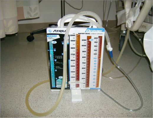 <p>What is the&nbsp;<strong>function</strong>&nbsp;of this?</p>