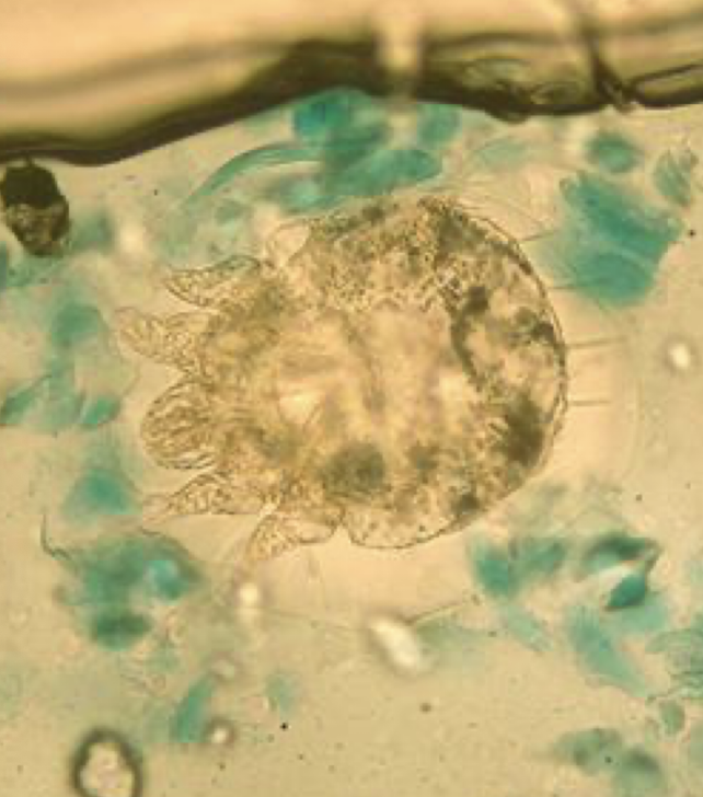 <p>What ectoparasite is this?</p>