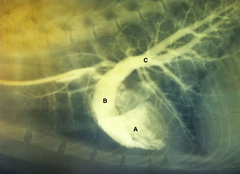 <p>What is structure A?</p><p>a. Main Pulmonary Artery</p><p>b. Right Ventricle</p><p>c. Caudal Lobar Arteries</p>
