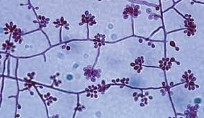 <p>dimorphic</p><p>yeast form- cigar shaped</p>