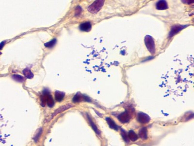 <p><strong>Image citation:</strong><br><em>Newcomer Supply. (n.d.). Gram, Brown-Hopps stain kit [Photomicrograph]. Fisher Scientific.</em></p>