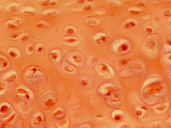 <p>identify the tissue</p>