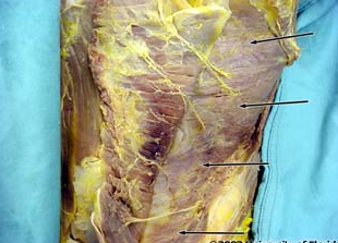 <p>what muscle is being indicated in the image?</p>