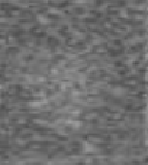 <p>The same echogenicity, same shade as another structure</p>