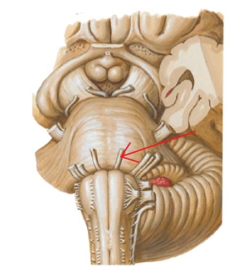 <p>Cranial Nerve VI</p>