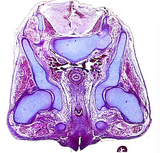 <p>Label the following:</p><ul><li><p>acetabulum</p></li><li><p>femoral head</p></li><li><p>labrum</p></li></ul><p></p>