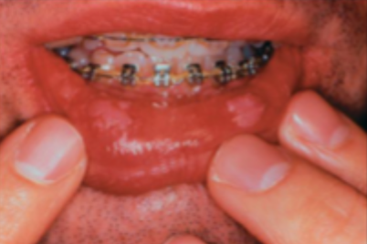 <p>what is this condition</p>