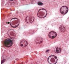 <p>What is being shown in this histology image?</p>