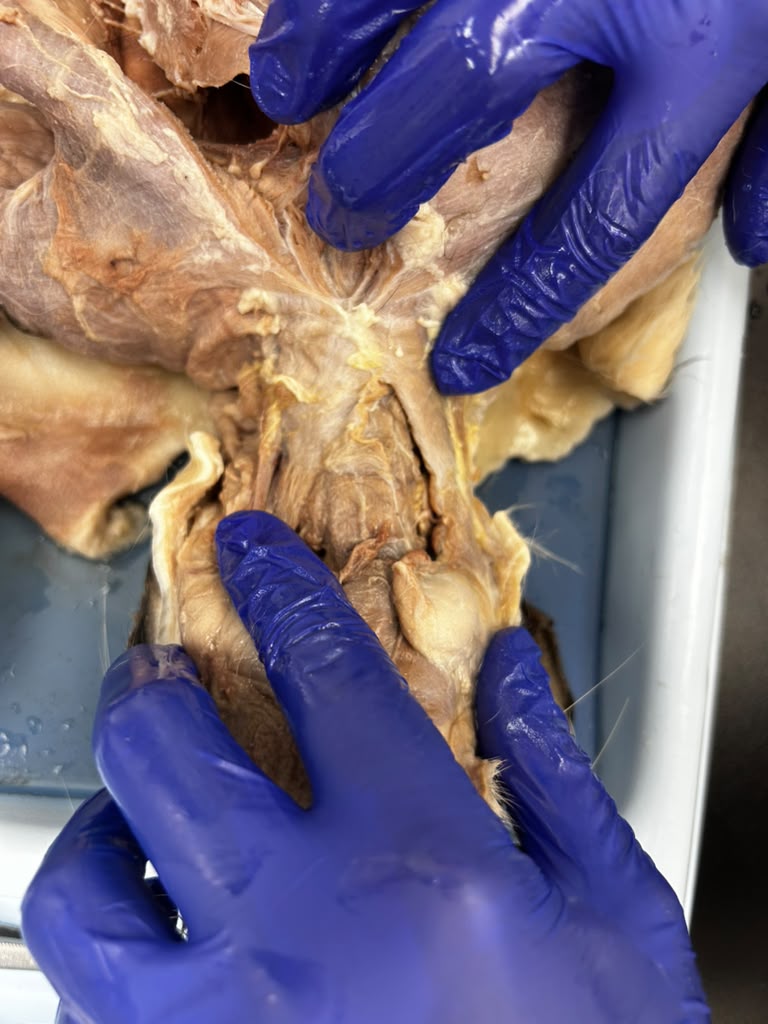 <p>What is the insertion of this muscle?</p>