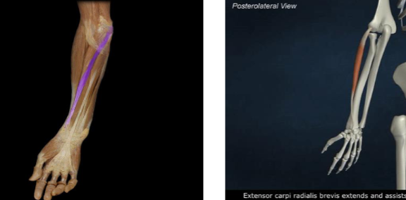 <p>wrist flexion and radial deviation</p>