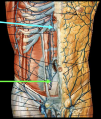 <p>Identify the structure at the green arrow</p>