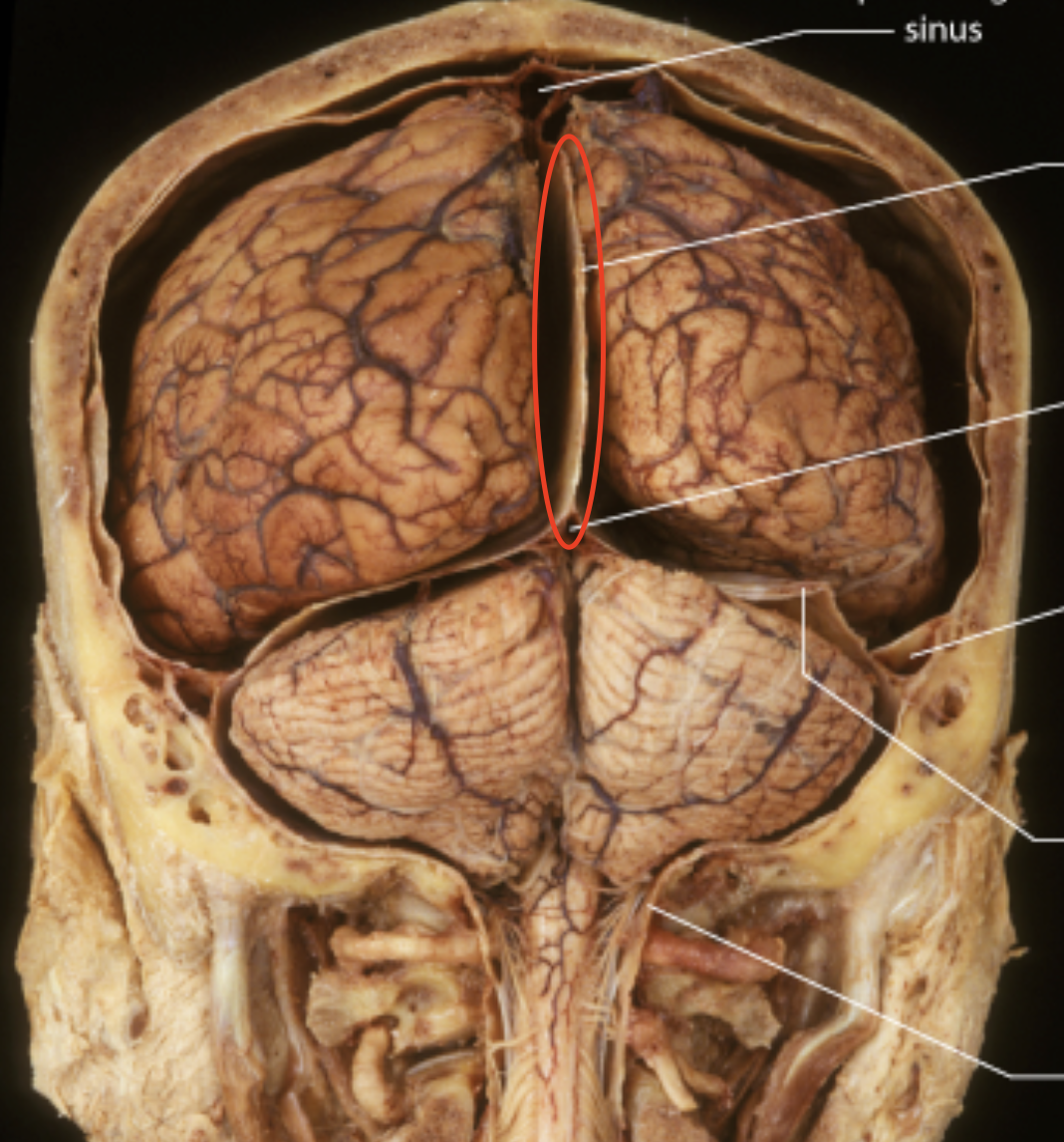 <p>Seperates the right and left cerebrum </p>