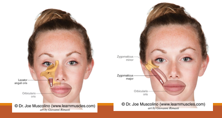 <p>Levator anguli oris</p><p>Zygomatic major</p><p>Innervation: Both VII facial</p>