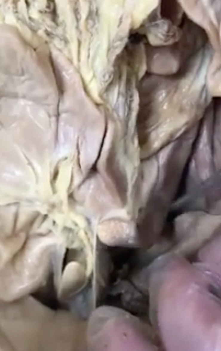 <p>what is region of intestines is prong pointing to (region right by stomach)</p>
