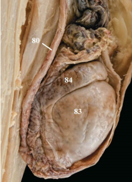 <p>Label 80, 83, 84 </p>