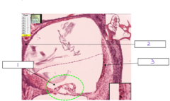 <p>What is the structure at 3</p>