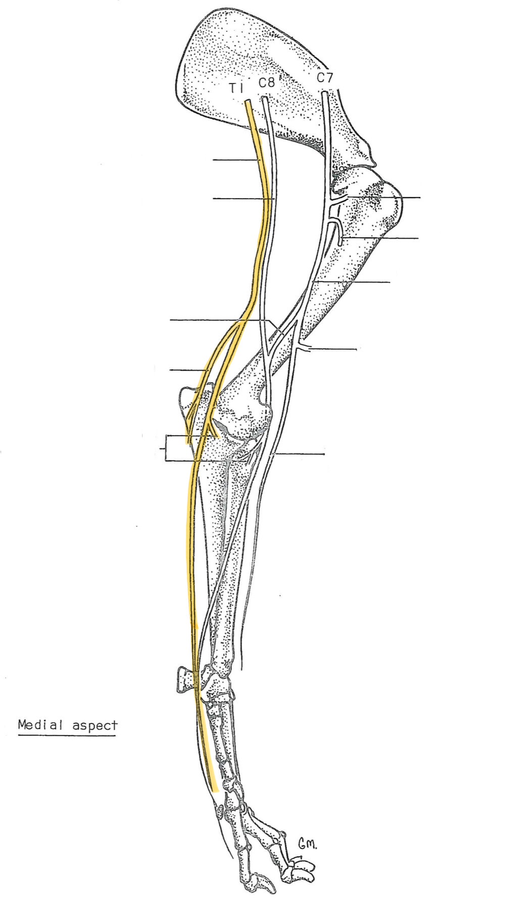 <p>originates from C8-T2</p><p>gives off caudal antebrachial cutaneous branch above the elbow</p><p>innervates:</p><ul><li><p>carpus &amp; digit flexors</p><ul><li><p>flexor carpi ulnaris</p></li><li><p>deep digital flexors</p></li></ul></li><li><p>skin of caudal antebrachium, palmar paw, &amp; 5 metacarpal</p></li></ul><p></p>