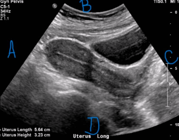 <p><span style="background-color: transparent;">&nbsp;What is letter C in this image?&nbsp;</span></p><p><span style="background-color: transparent;">a. Left&nbsp;</span></p><p><span style="background-color: transparent;">b. Posterior&nbsp;</span></p><p><span style="background-color: transparent;">c. Inferior&nbsp;</span></p><p><span style="background-color: transparent;">d. Superior&nbsp;</span></p>