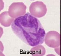 <p>Describe the morphology of a basophil</p>