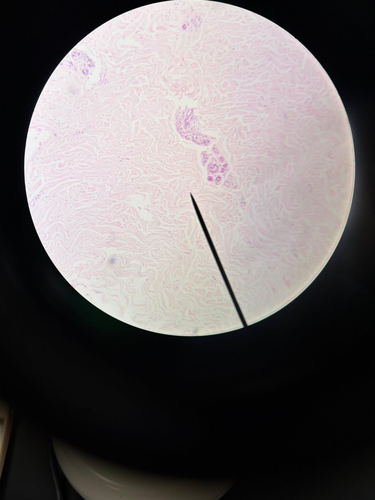 <p>Which connective tissue is shown?</p>