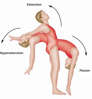 <p>Hyperextension</p>