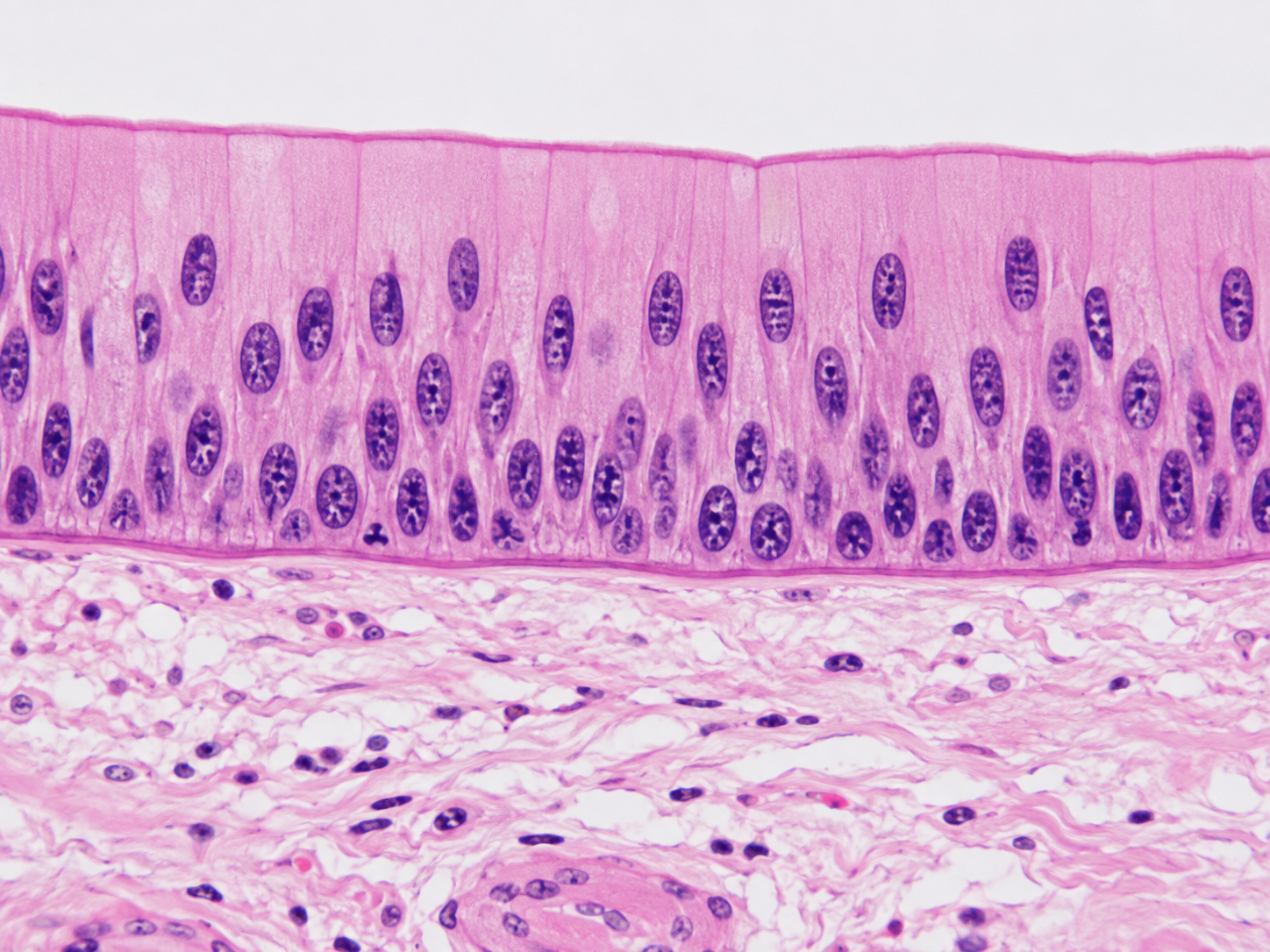 <p>What type of Epithelial Tissue is this?</p>