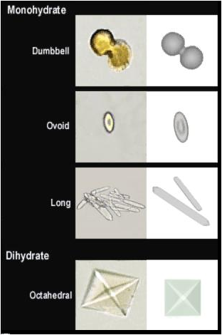 <p>Calcium oxalate monohydrate</p>