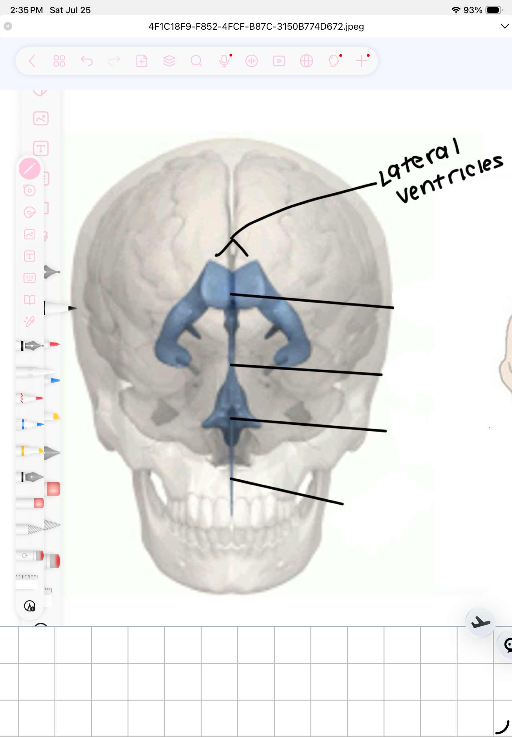 term image