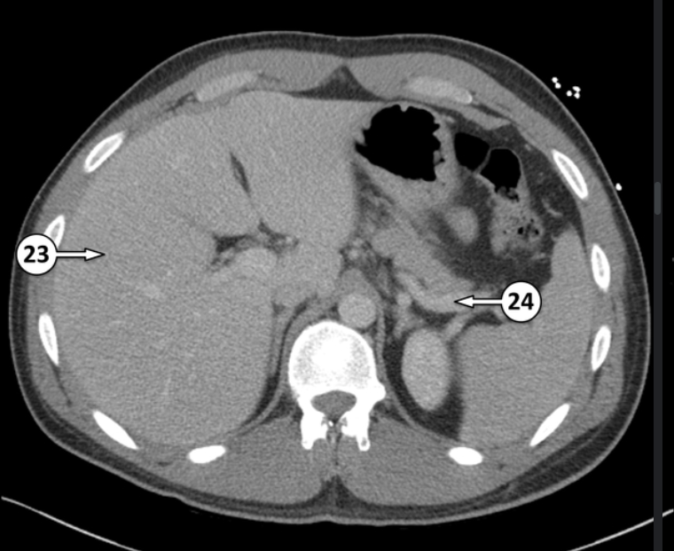 <p>Label 23 and 24 </p>