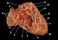 <p>#5</p>