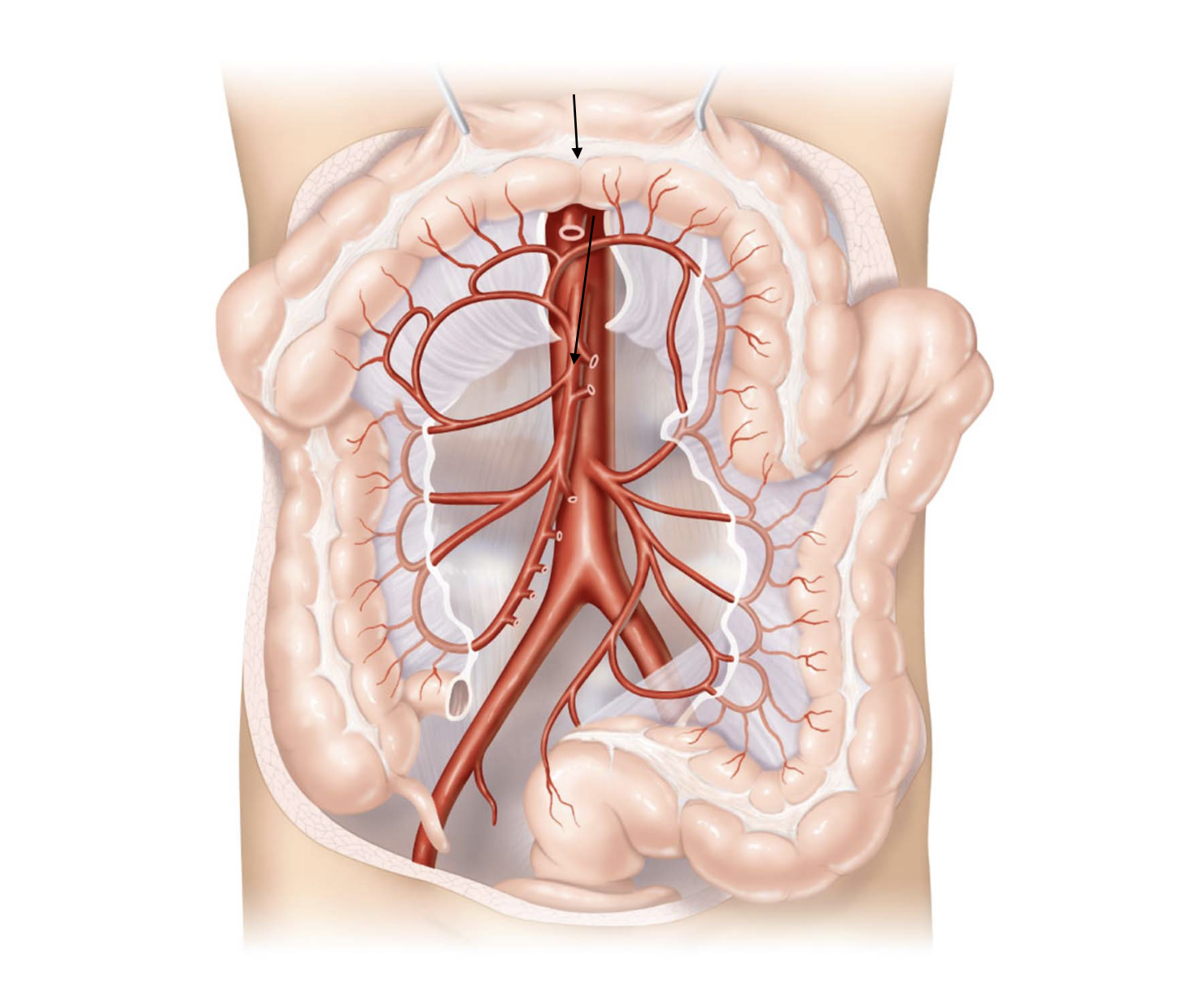 <p>Aorta</p><ul><li><p>→ thoracic aorta</p><ul><li><p>→ abdominal aorta</p><ul><li><p>→ superior mesenteric artery</p><ul><li><p></p><ul><li><p>← superior mesenteric vein</p></li></ul></li><li><p>← hepatic portal vein</p></li></ul></li><li><p>← liver</p></li></ul></li><li><p>← hepatic veins</p></li></ul></li><li><p>← inferior vena cava</p></li></ul><p>Right Atrium</p><p></p>