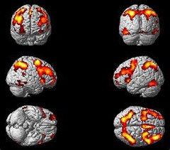 <p>a technique for revealing bloodflow and, therefore, brain activity by comparing successive MRI scans. fMRI scans show brain function as well as structure.</p>