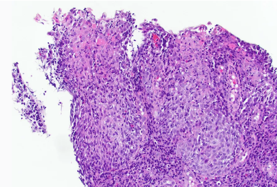 <p>1) Diagnostic</p><p>2 )Cut off</p><p>3) associations </p>