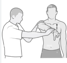 <p>Hold the arm straight out in front. First point the thumb down and resist someone pushing down. Then turn the palm up and repeat. Pain only in the first position is positive.</p>