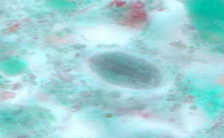 <p><span style="background-color: rgba(0, 0, 0, 0); line-height: 19.7625px;">What is the species in this photo? WHY?</span></p>