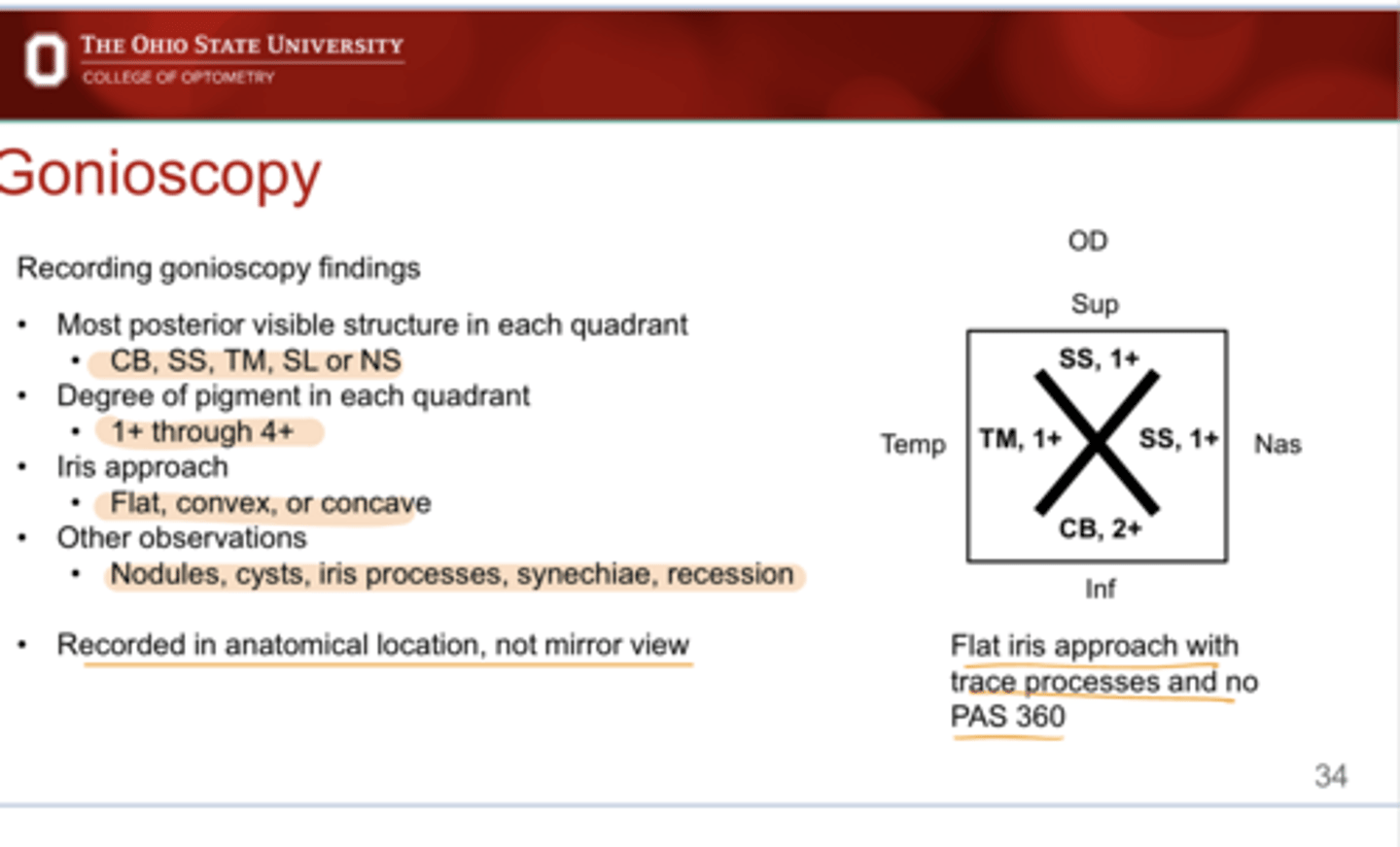 <p>Recorded Gonioscopy Findings -- Flat Iris Approach with Trace Processes and No PAS 360 (Pic)</p>