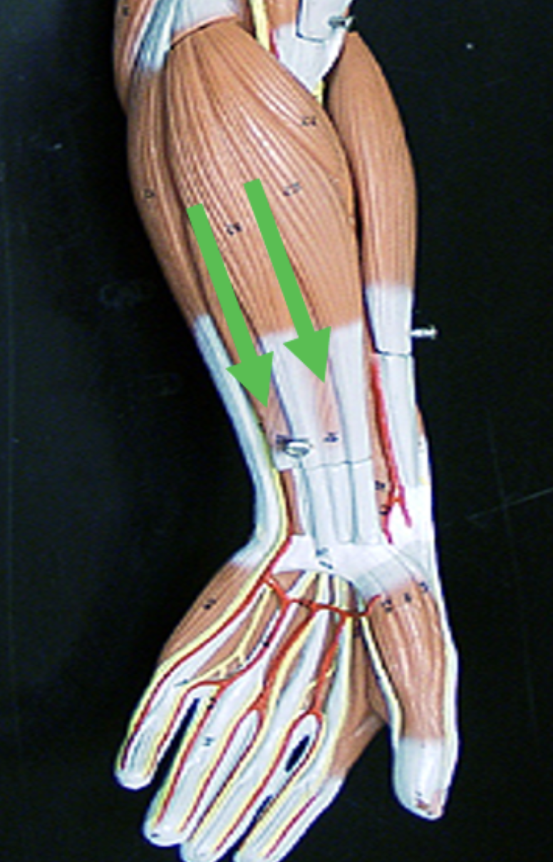 <p>Identify the muscle indicated by the pointer.</p>