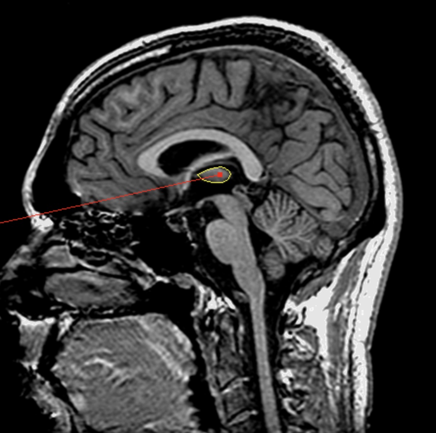 <p>What is the area highlighted called?</p>