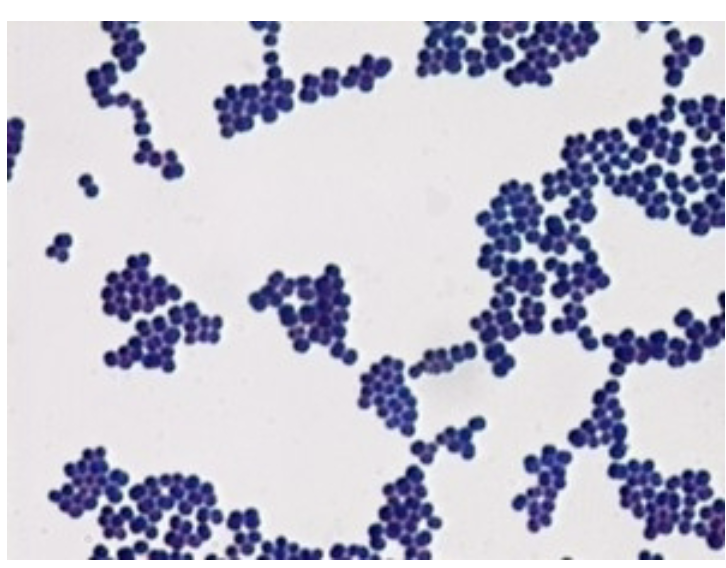 <p><strong>Located</strong>: Nares, axillae, vagina, pharynx, and skin surfaces</p><p><strong>Gram stain</strong>: Gram Positive Cocci</p><p><strong>Morphology</strong>:<strong> </strong>yellowish white, Beta hemolytic</p><p><strong>Virulence factors</strong>: enterotoxins, toxic shock syndrome (toxin-1), Exfoliative toxin, cytolytic toxins, Enzymes, lipase, hyaluronidase, and Pro A</p><p><strong>Catalase:</strong> positive</p><p><strong>Plate growth</strong>: Blood agar, Chocolate agar, Mannitol Salt Agar, MRSA chromagar as additional culturing media </p>