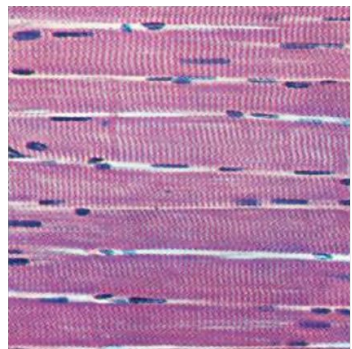 <p>Skeletal Muscle</p>